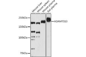 Western blot analysis of extracts of various cell lines, using  antibody (ABIN7265440) at 1:1000 dilution.