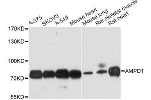 Western blot analysis of extracts of various cell lines, using AMPD1 antibody. (AMPD1 抗体  (AA 50-260))