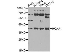 Western blot analysis of extracts of various cell lines, using HOXA1 antibody (ABIN2563217) at 1:1000 dilution. (HOXA1 抗体)