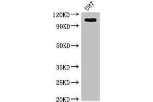 Western Blot Positive WB detected in: U87 whole cell lysate All lanes: HK2 antibody at 4 μg/mL Secondary Goat polyclonal to rabbit IgG at 1/50000 dilution Predicted band size: 103 kDa Observed band size: 103 kDa (Hexokinase 2 抗体  (AA 334-526))