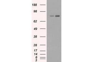 HEK293T cells were transfected with the pCMV6-ENTRY control (Left lane) or pCMV6-ENTRY FERMT2 (Right lane) cDNA for 48 hrs and lysed. (FERMT2 抗体)