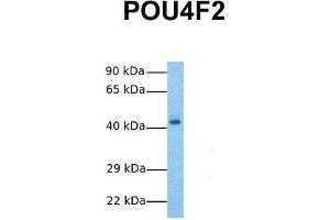 Host:  Rabbit  Target Name:  POU4F2  Sample Tissue:  Human Fetal Liver  Antibody Dilution:  1. (POU4F2 抗体  (N-Term))