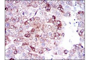 Immunohistochemistry (IHC) image for anti-Solute Carrier Family 27 (Fatty Acid Transporter), Member 5 (SLC27A5) (AA 508-570) antibody (ABIN1845742)