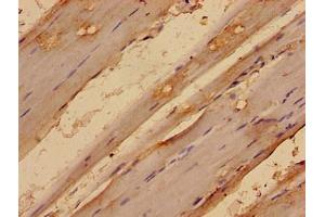 Immunohistochemistry analysis of human skeletal muscle tissue using ABIN7159132 at dilution of 1:100 (MED24 抗体  (AA 1-300))