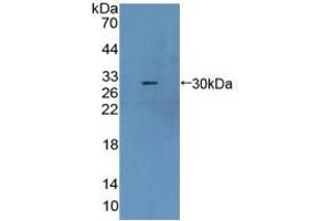 Detection of Recombinant CBR1, Mouse using Polyclonal Antibody to Carbonyl Reductase 1 (CBR1) (CBR1 抗体  (AA 66-271))