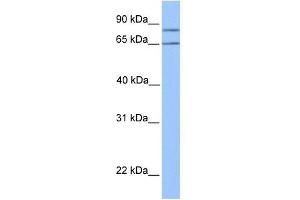 OXCT2 antibody used at 1 ug/ml to detect target protein. (OXCT2 抗体  (Middle Region))