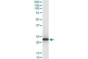 Western Blotting (WB) image for anti-Tumor Protein, Translationally-Controlled 1 (TPT1) (AA 35-138) antibody (ABIN521072)
