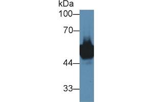Western Blotting (WB) image for anti-Ly1 Antibody Reactive (LYAR) (AA 270-388) antibody (ABIN7439300)