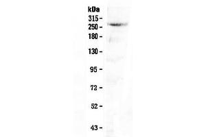 Western blot analysis of CAD using anti-CAD antibody .