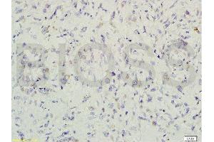 Immunohistochemistry (Paraffin-embedded Sections) (IHC (p)) image for anti-Gremlin 1 (GREM1) (AA 101-184) antibody (ABIN687082)
