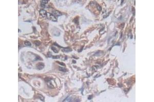 IHC-P analysis of Human Tissue, with DAB staining. (PKN2 抗体  (AA 323-464))