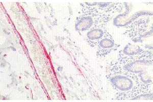 Immunohistochemistry (IHC) image for anti-Collagen, Type VIII, alpha 1 (COL8A1) (AA 583-743) antibody (ABIN7437536)