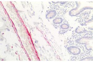 Detection of COL8a1 in Human Small intestine Tissue using Polyclonal Antibody to Collagen Type VIII Alpha 1 (COL8a1) (COL8A1 抗体  (AA 583-743))