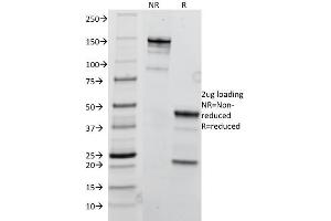 SDS-PAGE Analysis Purified TRIM29 Mouse Monoclonal Antibody (TRIM29/1041). (TRIM29 抗体  (AA 1-200))