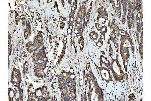 IHC analysis of RGS12 using anti-RGS12 antibody (ABIN7602410).