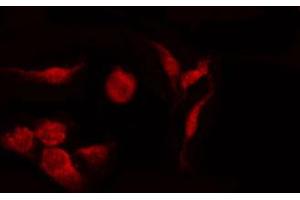 ABIN6274361 staining Hela by IF/ICC. (CDK5R1 抗体  (N-Term))