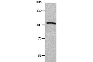 Western Blotting (WB) image for anti-ADAM Metallopeptidase with thrombospondin Type 1 Motif, 5 (ADAMTS5) antibody (ABIN2425574) (ADAMTS5 抗体)