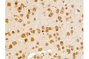 ABIN7094836 and ABIN7098887 at 1/100 staining Rat brain tissue by IHC-P.