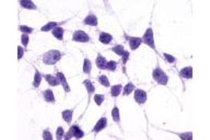 Anti-GRM3 / MGLUR3 antibody immunocytochemistry (ICC) staining of untransfected HEK293 human embryonic kidney cells. (Metabotropic Glutamate Receptor 3 抗体  (N-Term))