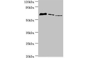 Western blot All lanes: Tyrosyl-DNA phosphodiesterase 1 antibody at 8 μg/mL Lane 1: MCF-7 whole cell lysate Lane 2: Mouse lung tissue Lane 3: Rat brain tissue Secondary Goat polyclonal to rabbit IgG at 1/10000 dilution Predicted band size: 69, 42 kDa Observed band size: 69 kDa (TDP1 抗体  (AA 1-260))