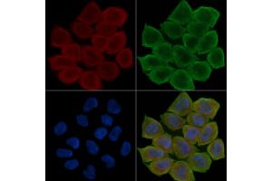 ABIN6266234 and ABIN6277388 staining Hela cells(30 min of UV treatment) by IF/ICC.