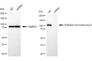 Western blotting analysis using epithelial cell transforming 2 antibody (ABIN7798482). (ECT2 抗体)