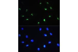 Immunofluorescence analysis of H9C2 cells using NOP58 Rabbit pAb (ABIN1681073, ABIN3019190, ABIN3019191 and ABIN6220753) at dilution of 1:100. (NOP58 抗体  (AA 360-529))