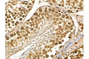 MYEOV Antibody at 1/100 staining Rat testis tissue by IHC-P. (MYEOV 抗体  (Internal Region))