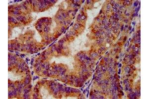 Immunohistochemistry (IHC) image for anti-POU Class 5 Homeobox 1 (POU5F1) (AA 1-360) antibody (ABIN7164068)