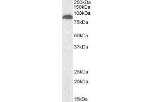 Biotinylated ABIN4902784 (2µg/ml) staining of Human Pancreas lysate (35µg protein in RIPA buffer), exactly mirroring its parental non-biotinylated product. (TRPV5 抗体  (Internal Region) (Biotin))