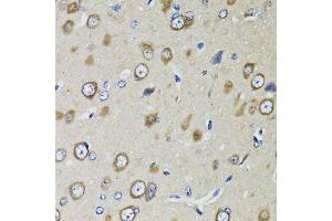 Immunohistochemistry (Paraffin-embedded Sections) (IHC (p)) image for anti-Ribosomal Protein S10 (RPS10) (AA 1-165) antibody (ABIN6147191)