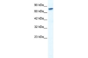 WB Suggested Anti-RUNX2 Antibody Titration:  1. (RUNX2 抗体  (Middle Region))