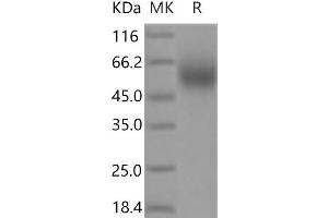 Western Blotting (WB) image for Poliovirus Receptor-Related 1 (Herpesvirus Entry Mediator C) (PVRL1) protein (His tag) (ABIN7321172)