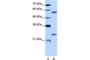 Western Blotting (WB) image for anti-Copine I (CPNE1) antibody (ABIN2462160) (CPNE1 抗体)