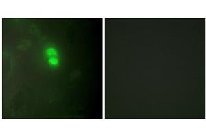 Immunofluorescence analysis of HeLa cells, using Dyskerin antibody. (DKC1 抗体  (Internal Region))