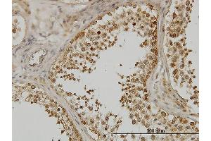 Immunoperoxidase of monoclonal antibody to DDX3Y on formalin-fixed paraffin-embedded human testis. (DDX3Y 抗体  (AA 1-80))