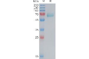 Mouse E Protein, His Tag on SDS-PAGE under reducing condition.