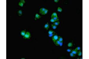 Immunofluorescent analysis of MCF-7 cells using ABIN7143067 at dilution of 1:100 and Alexa Fluor 488-congugated AffiniPure Goat Anti-Rabbit IgG(H+L) (ACTL9 抗体  (AA 1-160))