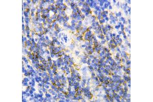 Anti-Annexin VI antibody, IHC(P) IHC(P): Rat Spleen Tissue (ANXA6 抗体  (C-Term))