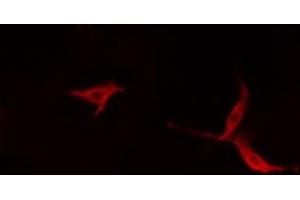 ABIN6279568 staining HepG2 cells by IF/ICC. (Myosin XVI 抗体  (Internal Region))