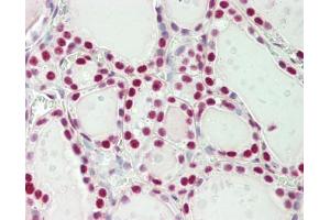 Human Thyroid: Formalin-Fixed, Paraffin-Embedded (FFPE)