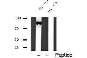Western blot analysis of extracts of HL-60 cells, using IFT88 antibody. (IFT88 抗体  (C-Term))