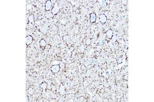 Immunohistochemistry (IHC) image for anti-Glutamate Decarboxylase 1 (Brain, 67kDa) (GAD1) (AA 1-200) antibody (ABIN3017019)