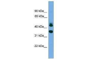 FLJ30934 antibody used at 0. (FLJ30934 (Middle Region) 抗体)