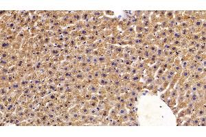 Detection of RSPO1 in Mouse Liver Tissue using Polyclonal Antibody to R-Spondin 1 (RSPO1)