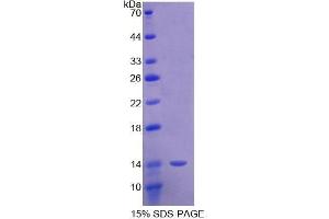 SDS-PAGE (SDS) image for Sema Domain, Immunoglobulin Domain (Ig), Short Basic Domain, Secreted, (Semaphorin) 3E (SEMA3E) protein (ABIN3011607)