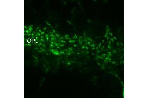 Indirect immunostaining of ribbon synapses in the outer plexiform layer of PFA mouse retina (dilution 1 : 1000). (RIMS2 抗体  (AA 925-1114))