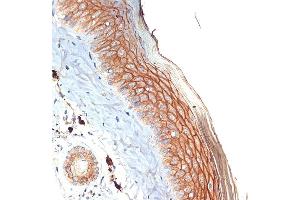 Immunohistochemistry (IHC) image for anti-TP53 Apoptosis Effector (PERP) antibody (ABIN7270861)