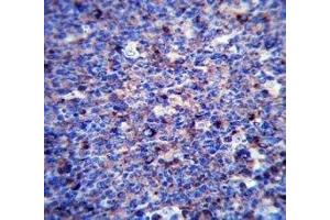 MMP3 antibody immunohistochemistry analysis in formalin fixed and paraffin embedded human tonsil tissue. (MMP3 抗体  (AA 30-59))