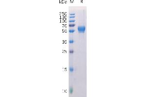 Human Protein, His Tag on SDS-PAGE under reducing condition.